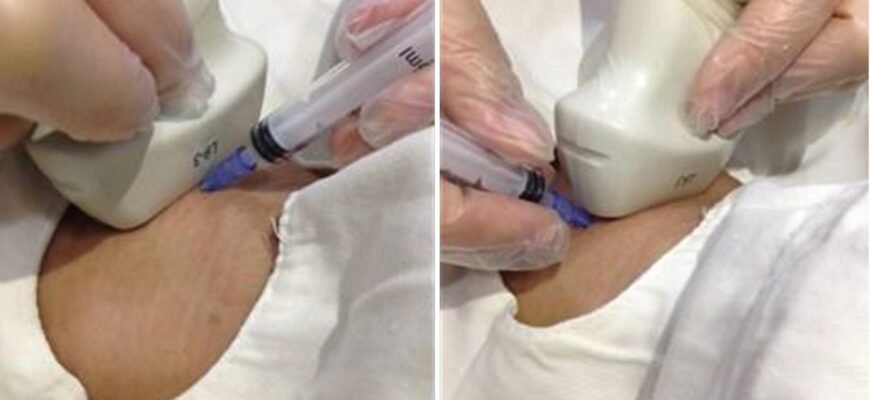 Які наслідки можливі після видалення паращитовидних залоз?