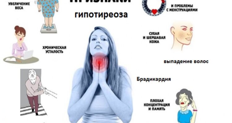 Наслідки гіпотиреозу: яким чином хвороба впливає на організм?