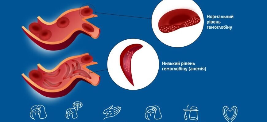 Чи можна померти від низького гемоглобіну: ризики та наслідки анемії