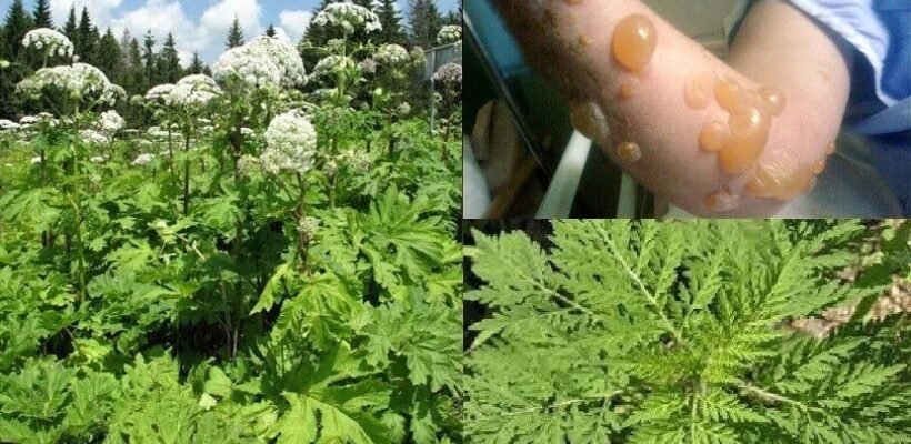 Борщівник: наслідки контакту й поради для безпечного ухилення