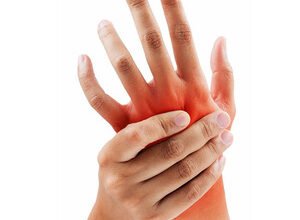 Чи можна парити руку після перелому: висновки експертів та рекомендації