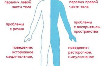 Наслідки ішемічного інсульту: як впливають на життя пацієнтів