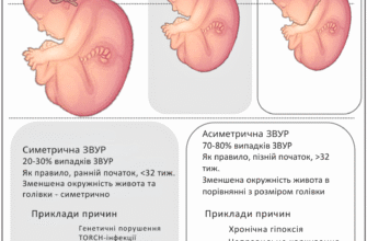Затримка розвитку плода: наслідки та можливі рішення для батьків