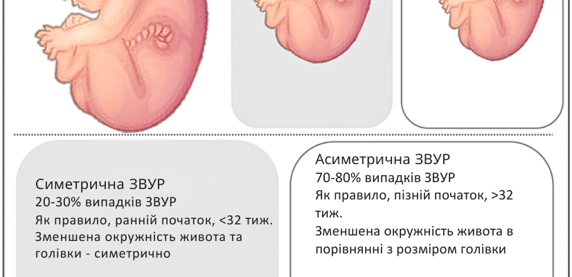 Затримка розвитку плода: які наслідки очікувати?