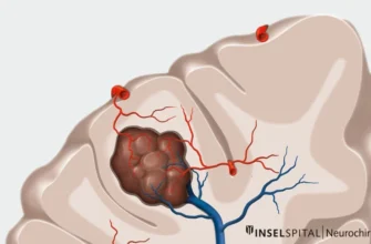 Наслідки після видалення каверноми: що варто знати пацієнтам?