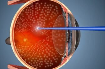 Лазерна коагуляція сітківки: наслідки та відновлення зору