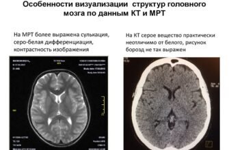 МРТ та КТ: Яка різниця? Вибір найкращого методу діагностики