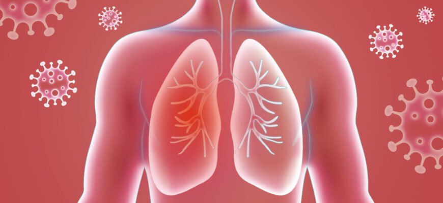 Чи можна при пневмонії виходити на вулицю: поради та застереження Чи можна при пневмонії виходити на вулицю: поради та застереження