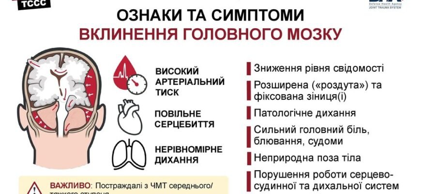 Наслідки черепно-мозкової травми: як уникнути ускладнень?