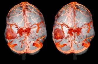 Кисневе голодування мозку: наслідки для здоров’я та життя
