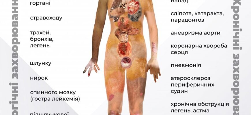 Віддалені наслідки від куріння: як шкідливі звички впливають на здоров’я