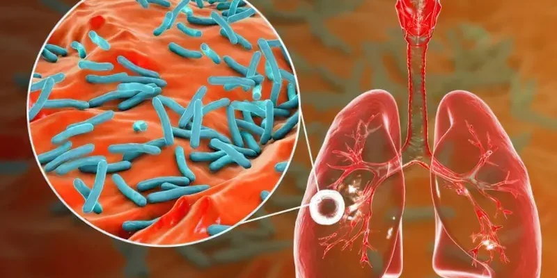 Легенева кровотеча: невідкладна допомога та перші кроки реагування