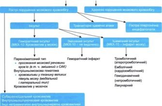Наслідки ГПМК МКХ 10: основні впливи на здоров’я та життя