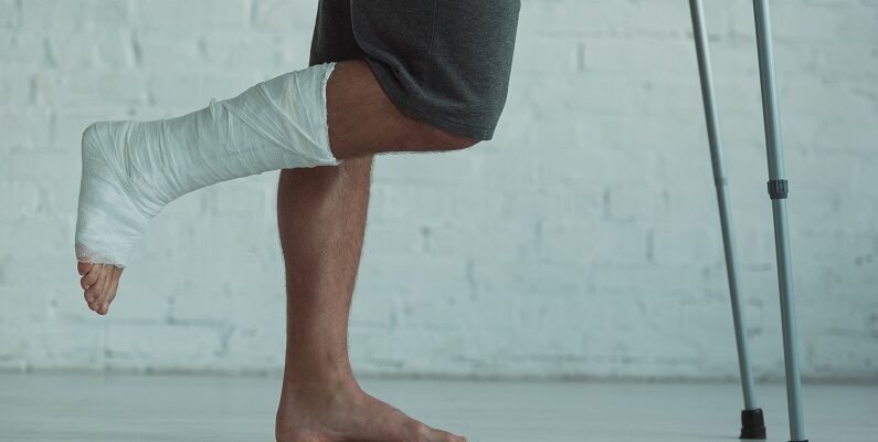 Чи можна ставати на ногу в гіпсі: поради та рекомендації лікарів