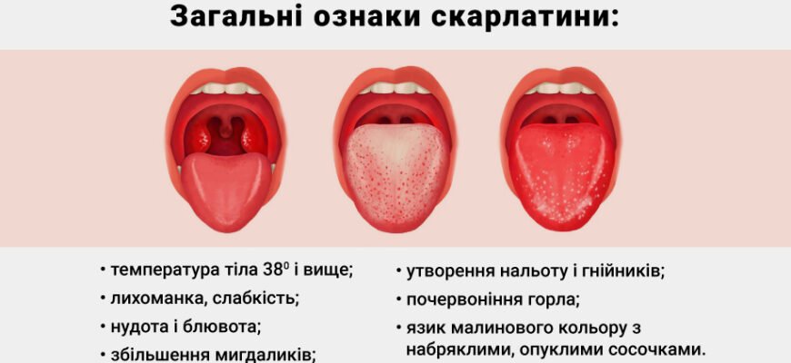 Наслідки скарлатини: як хвороба впливає на здоров’я та як запобігти
