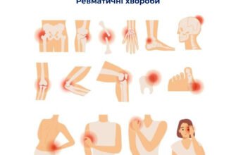 Наслідки ревматизму: Як хвороба впливає на ваше здоров’я?