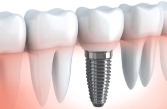 Чи можна спасти зуб, який хитається? Відповідь та рекомендації стоматолога