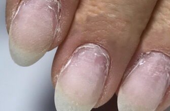 Наслідки гель лаку: вплив на здоров’я нігтів та шкіри
