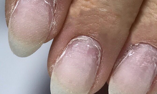 Наслідки гель лаку: вплив на здоров’я нігтів та шкіри