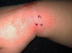 Укус щура: наслідки для здоров’я та заходи безпеки