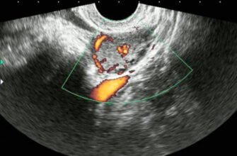 Чи можна завагітніти, коли є жовте тіло: важливі аспекти відповіді