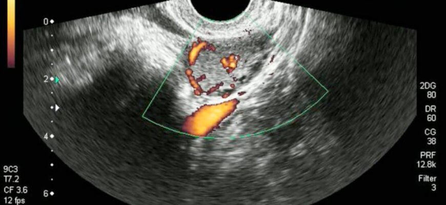 Чи можна завагітніти, коли є жовте тіло: важливі аспекти відповіді