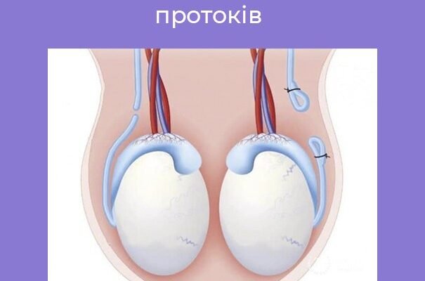 Вазектомія: наслідки та їх вплив на чоловіче здоров’я