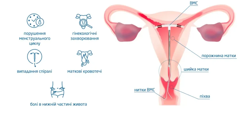 Наслідки спіралі: як вони впливають на наше життя та економіку