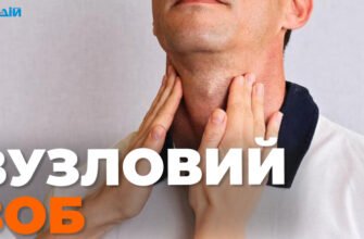 Чи можна вилікувати вузли на щитовидці: сучасні методи та поради
