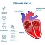 Види та симптоми порушення серцевого ритму — блог медичного центру ...