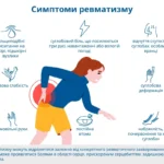 Що таке ревматизм та як його лікують — блог медичного центру ОН Клінік