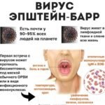 Вірус Епштейна-Барр: наслідки для здоров'я і як уберегтись від ...