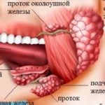 Видалення слинної залози — стаття у блозі медичної клініки Оксфорд ...
