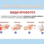 Види і наслідки кровотеч: Основні типи та їх вплив на здоров'я людини