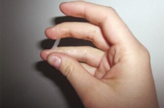 Желеподібні виділення у жінок: що це означає і як реагувати?