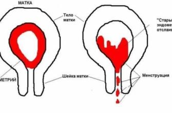 Чому виникають коричневі виділення під час місячних: причини та наслідки