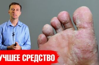 Ефективні методи лікування висипки та свербежу на ногах: поради лікарів