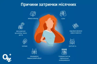 Затримка місячних і білі виділення: причини та що робити?