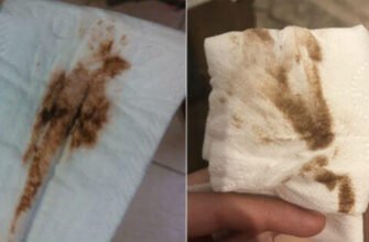 Коричневі виділення під час вагітності: причини та рекомендації лікарів