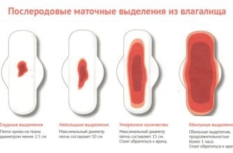 Кров’янисті виділення після Постинору: причини та що робити