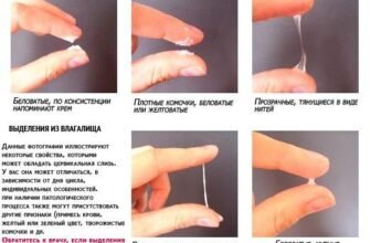 “Нормальні вагінальні виділення у жінок: пояснення та фото приклади”