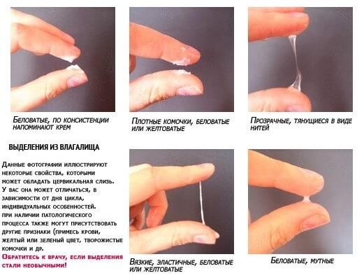 Нормальні виділення під час вагітності: ознаки та поради лікарів