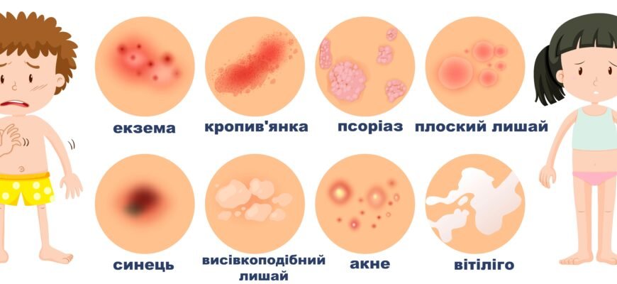 “Що таке подразнення: причини, симптоми та методи лікування”