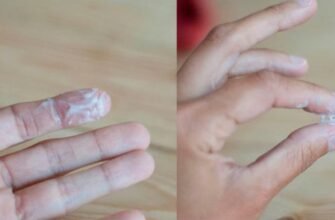 Зміни у виділеннях після овуляції: ознаки зачаття та що очікувати