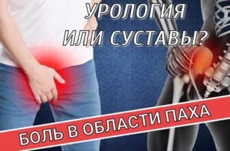 “Як лікувати подразнення в паху у чоловіків: поради та рекомендації”