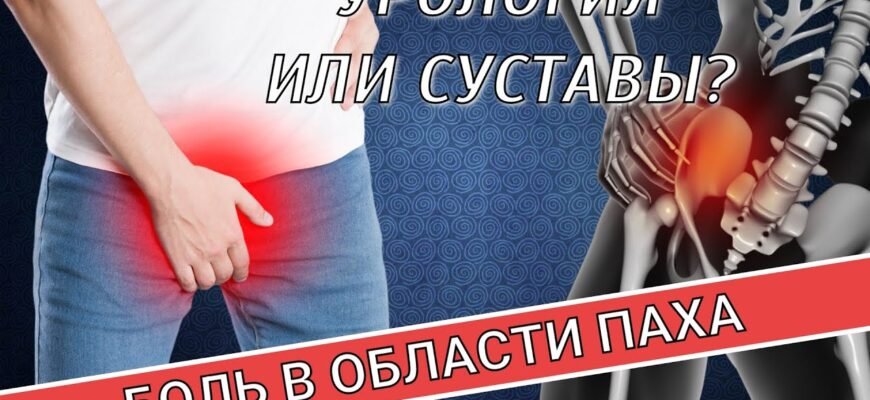 “Як лікувати подразнення в паху у чоловіків: поради та рекомендації”